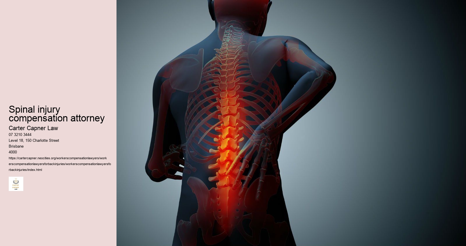 spinal injury compensation attorney