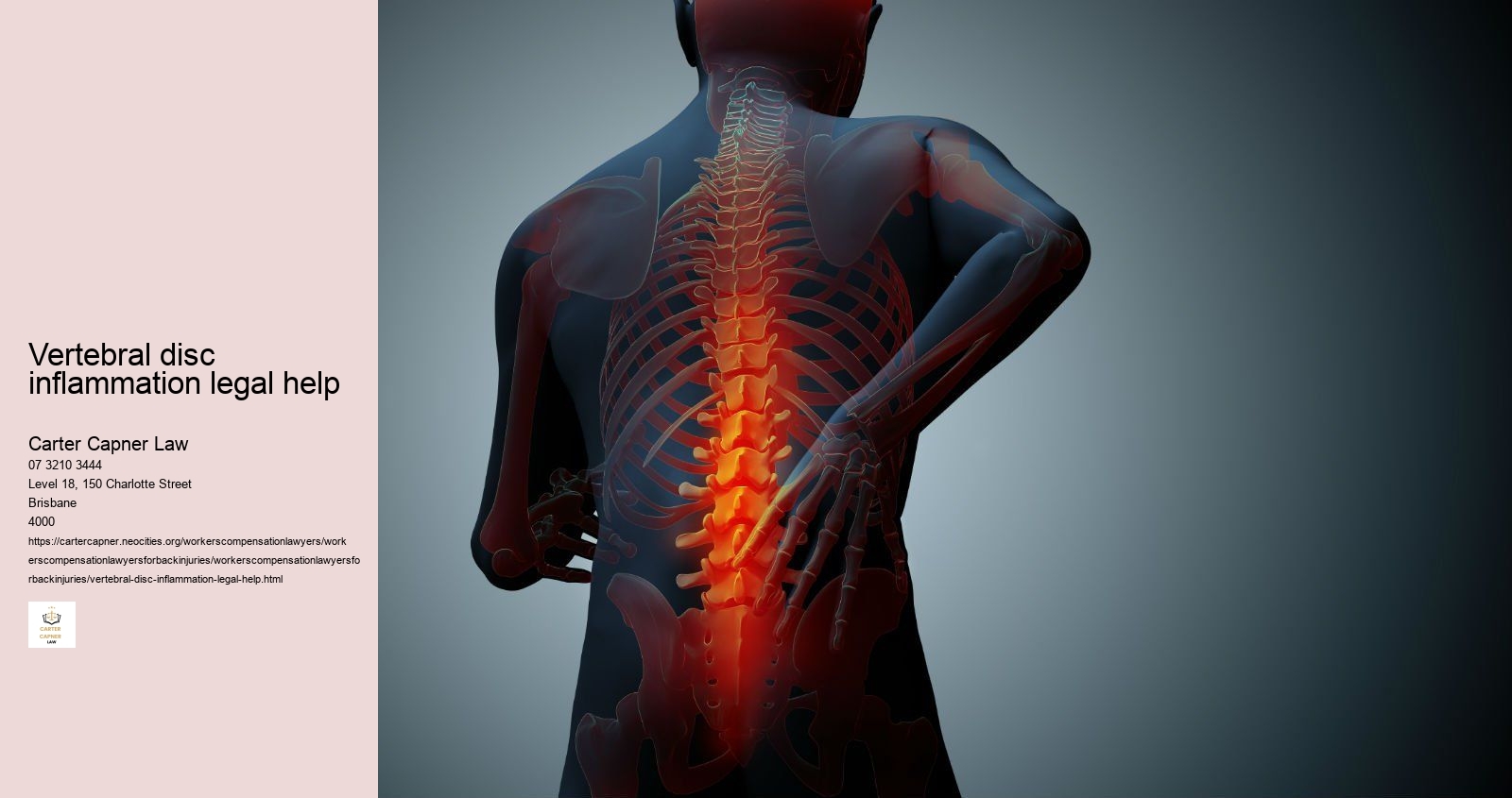 vertebral disc inflammation legal help 