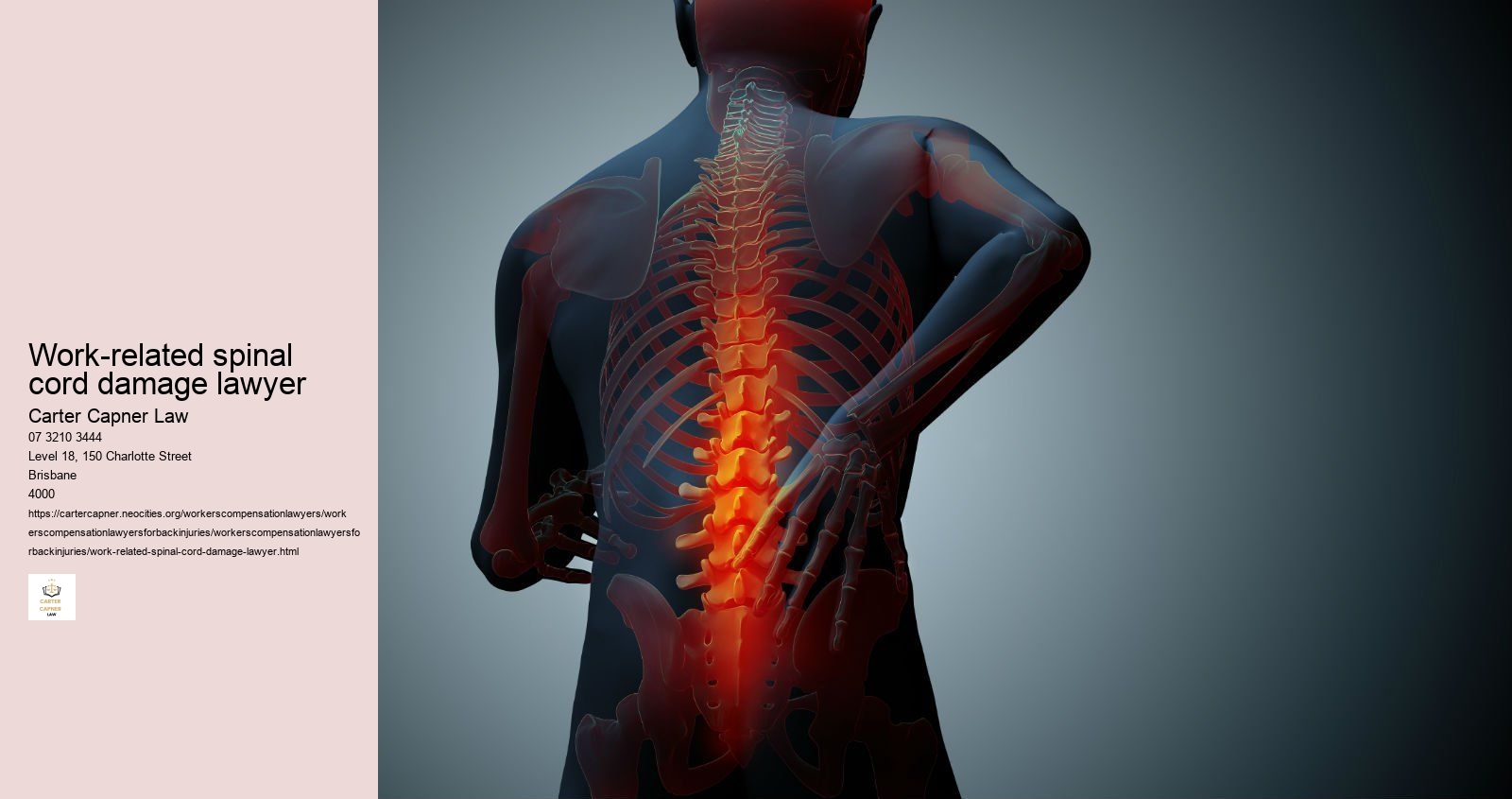 work-related spinal cord damage lawyer